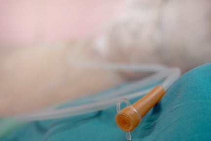 Automated nasogastric tube placement