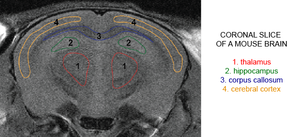 MRI image of a coronal slice of a mouse's brain.