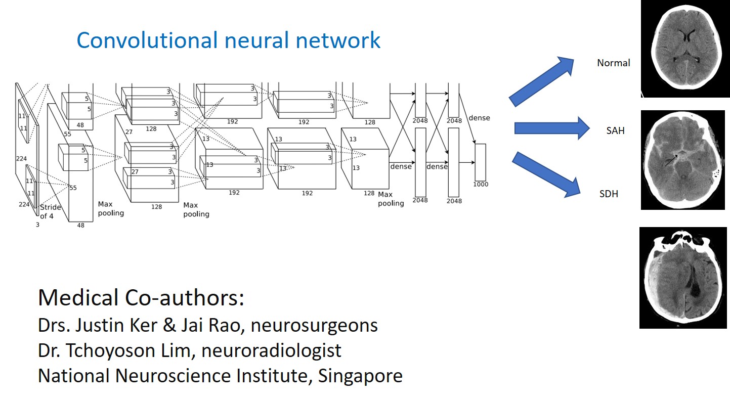 CT Brain Scans Diagnosis