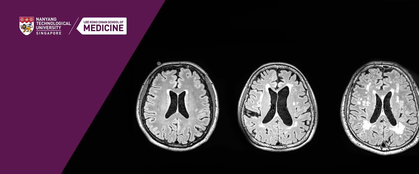 Dementia Research Centre (Singapore)